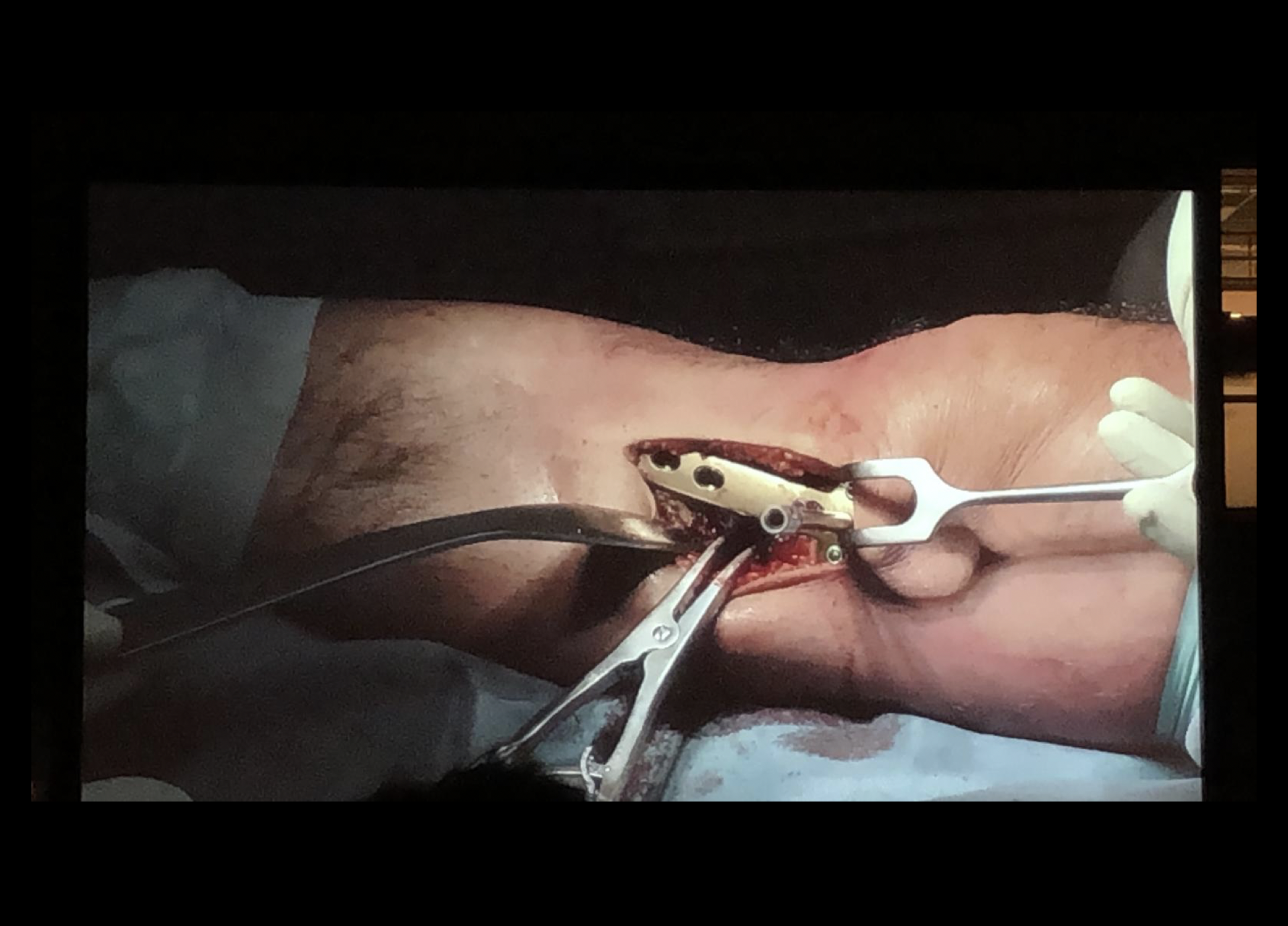 Congres fysiotherapie met live operatie: 